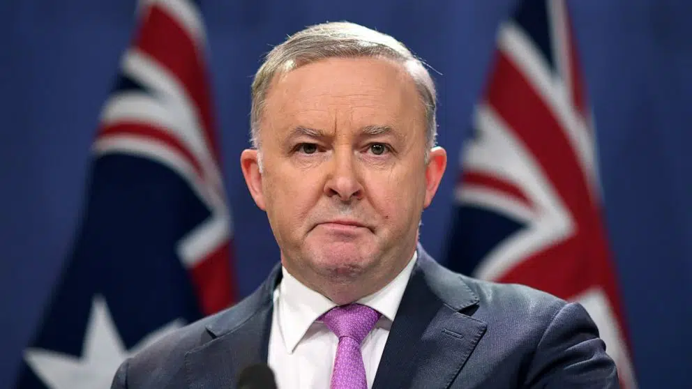 Anthony Albanese