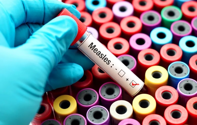 Health New Zealand has confirmed five new cases of measles.