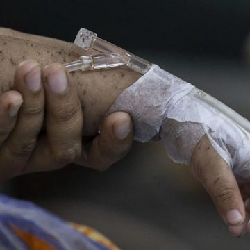 Over 500 children with suspected and confirmed cases of measles have died in Bangladesh since March, according to the country's health ministry.