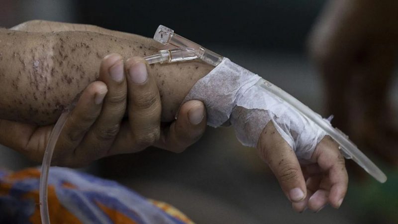 Over 500 children with suspected and confirmed cases of measles have died in Bangladesh since March, according to the country's health ministry.